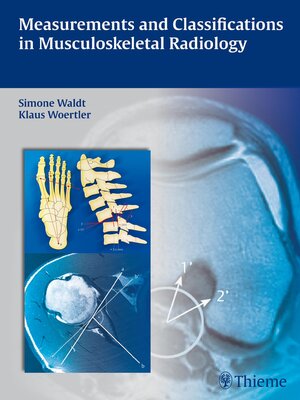 cover image of Measurements and Classifications in Musculoskeletal Radiology